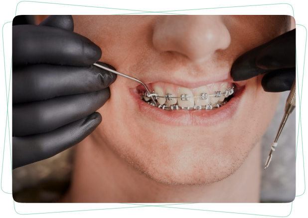 Orthodontics-dengal-tab